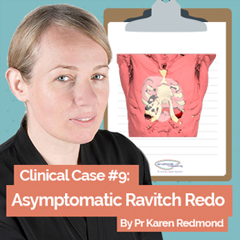 Cas clinique : Revision de Ravitch asymptomatique avec implant 3D par le Pr Karen Redmond