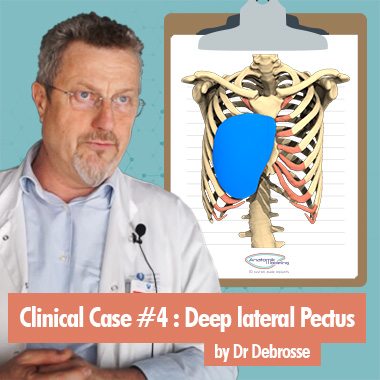 Clinical case on Pectus Excavatum by Dr Debrosse