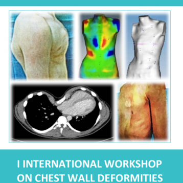 Workshop internazionale sulle deformazioni toraciche, Barcellona, Spagna, 19-20 ottobre 2017