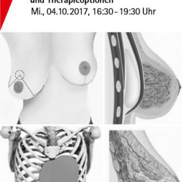 Symposium “ Angeborene Fehlbildung der Brust und Brustwand”, 4. Oktober 2017, Bonn