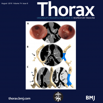 AnatomikModelings Arbeit auf der Titelseite des Journal Thorax !