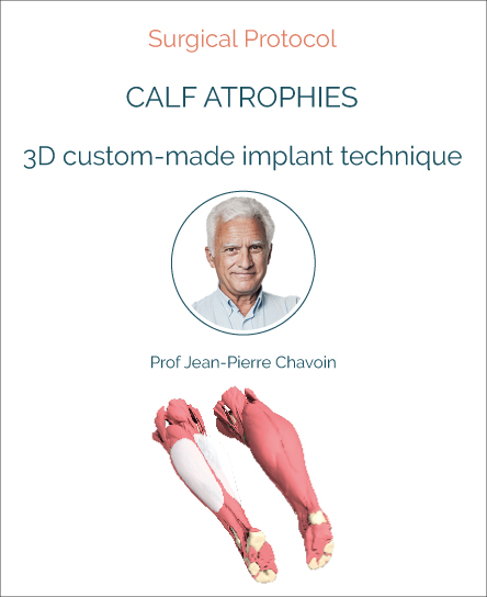 Surgery protocol for calf atrophy with implant technique