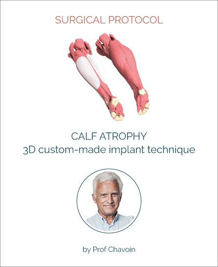 Surgery protocol for calf atrophy with implant technique