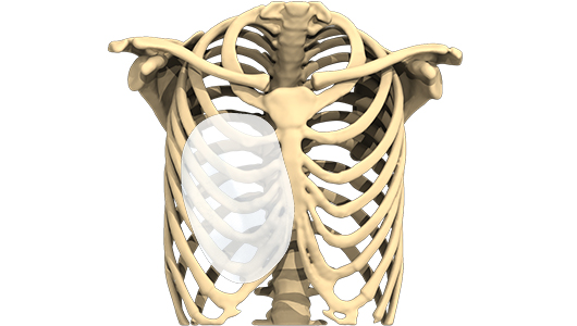 3D design of the implant to treat Pectus Excavatum