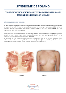 Fiche d'information Syndrome de Poland