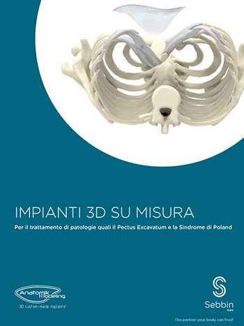 Brochure thoracic implants