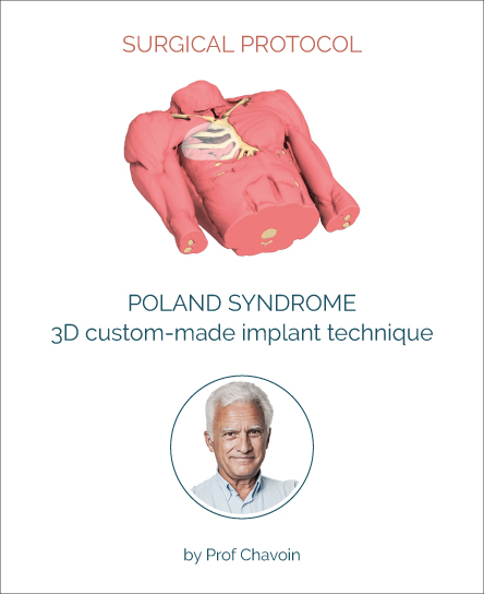 Surgery protocol for Poland Syndrome with implant technique