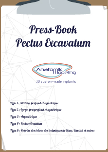 Press-book Pectus Excavatum
