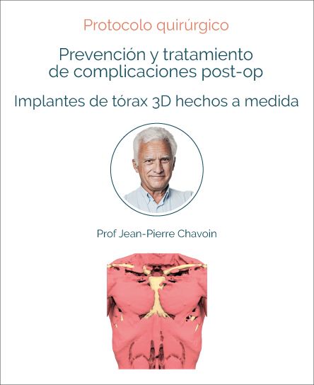 Complicaciones post operatorias de los implantes de tórax 3D hechos a medida: prevención y tratamiento