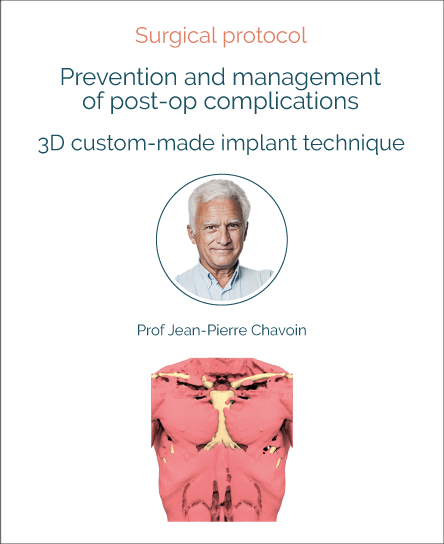 Post-operative complications of custom-made 3D thorax implants: prevention and management