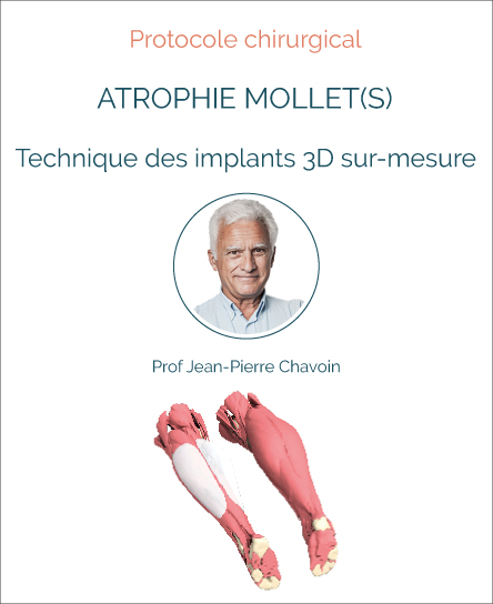 Protocole chirugie atrophie des mollets avec implants