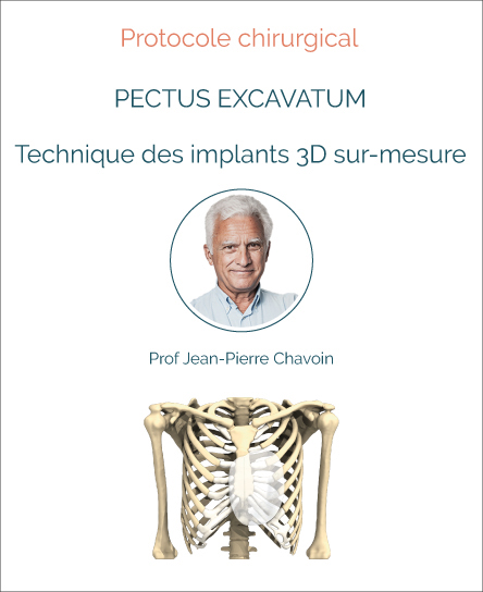 Protocole chirurgie pectus excavatum avec implants