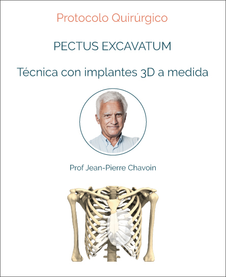 Surgery protocol for Pectus Excavatum with implant technique