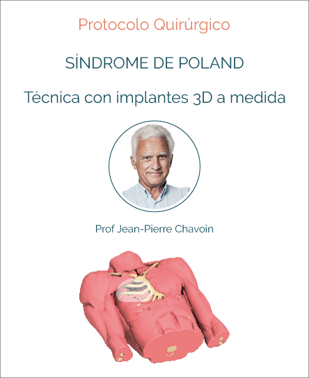 Surgery protocol for Poland Syndrome with implant technique