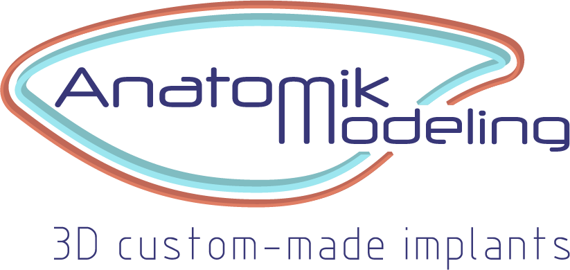 Pectus Excavatum surgery with implant video Pectus Excavatum surgery with implant technique video