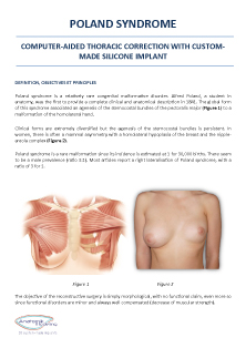 Poland Syndrome Information sheet