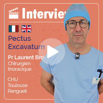 Interview du Pr Brouchet, chirurgien thoracique au CHU de Toulouse sur le Pectus