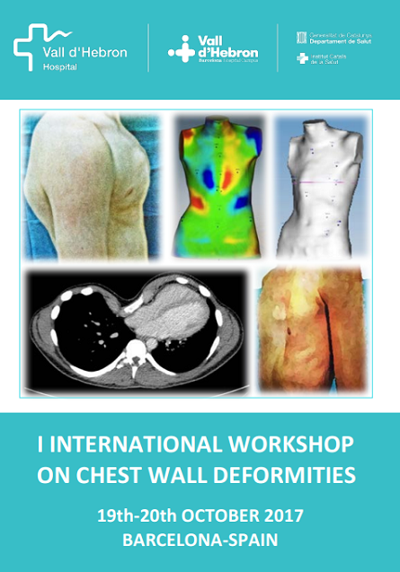 Workshop internazionale sulle deformazioni toraciche, Barcellona, Spagna, 19-20 ottobre 2017