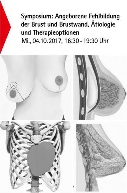 Simposio « Malformación congénita de la mama y la pared torácica », 4 Octubre  2017, Bonn, Alemania