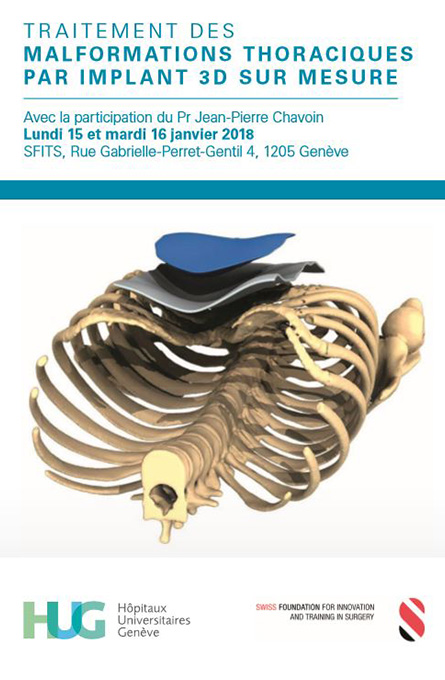 Symposium "Behandlung von Thoraxdeformitäten ", 15-16 Januar 2018, Genf, Schweiz