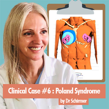 Clinical Case 6 by Dr Schirmer on Poland Syndrome