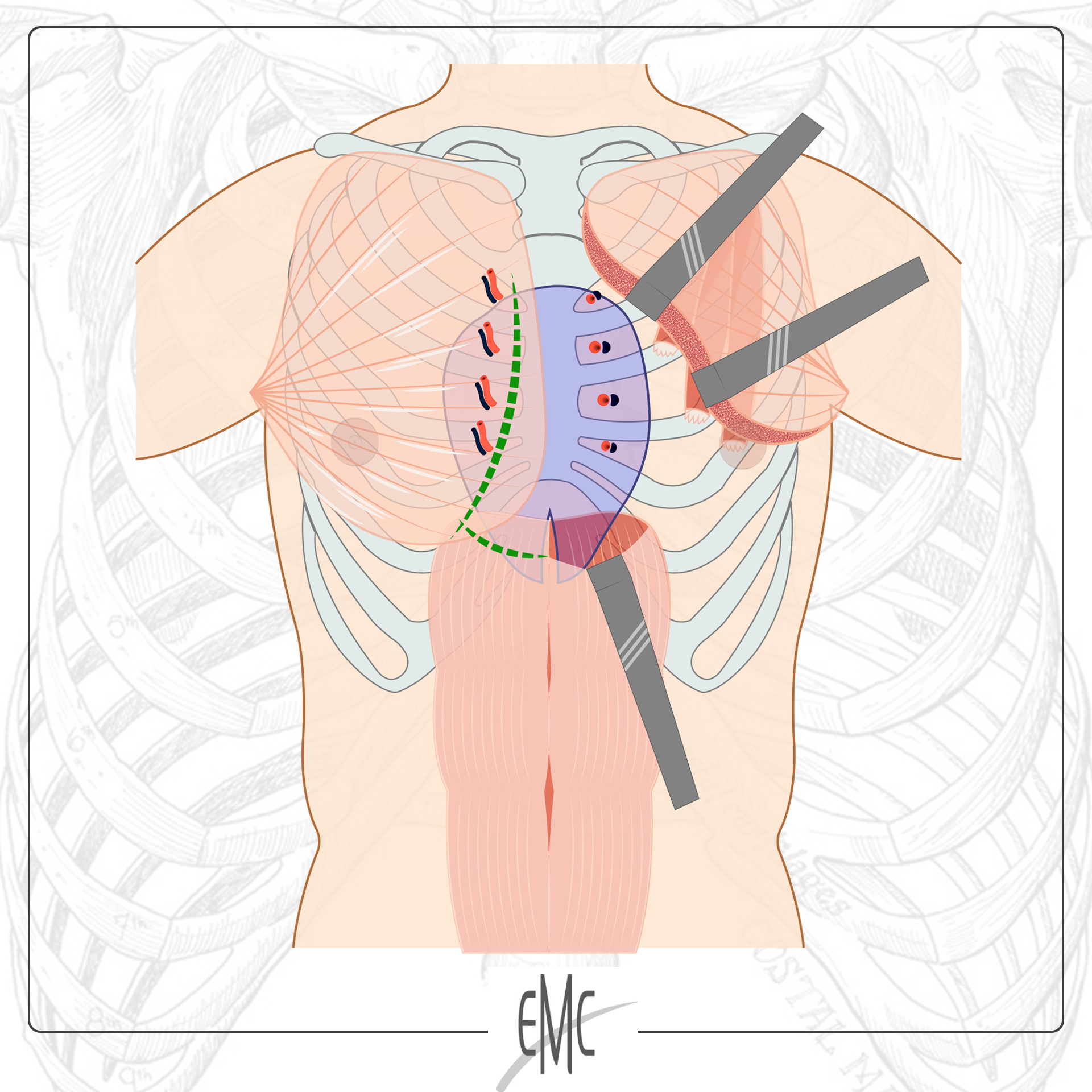 EMC - Nouvelle publication 2025