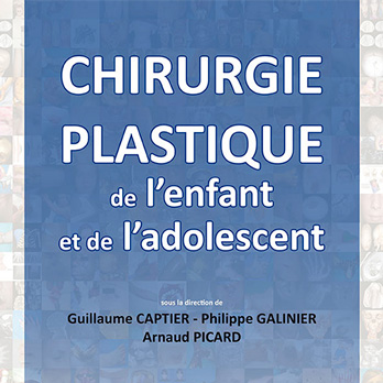 Chirurgie plastique de l'enfant et de l'adolescent