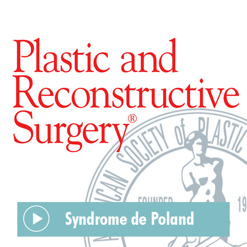 Plastic and Reconstructive Surgery Journal article on Poland Syndrome