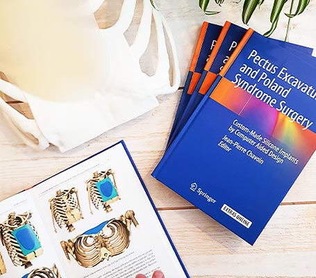 Publication Springer 2019 Pectus Excavatum et Syndrome de Poland