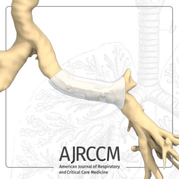 ARJCCM new publication: “Trumpet” 3D Stents for Left Anastomotic Complications After Lung Transplantation