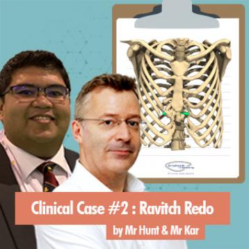 Clinical case of Ravitch redo on Pectus