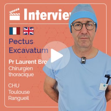 Interview du Pr Brouchet, chirurgien thoracique au CHU de Toulouse sur le Pectus