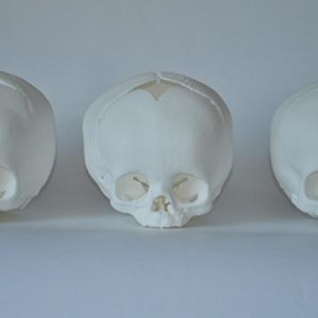  Stampa 3D: nuovo metodo di allenamento per l&#039;esame cranio