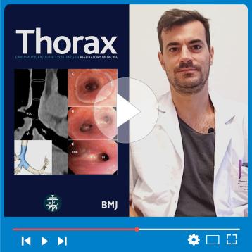 Pr Guibert comments his new publication in Thorax Journal