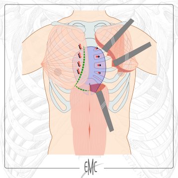 EMC - Nouvelle publication 2025