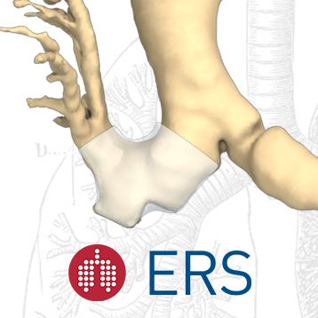 ERS publication: Examples of Novatech 3D virtual stent designs