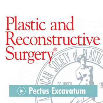 PRS Journal Pectus Excavatum